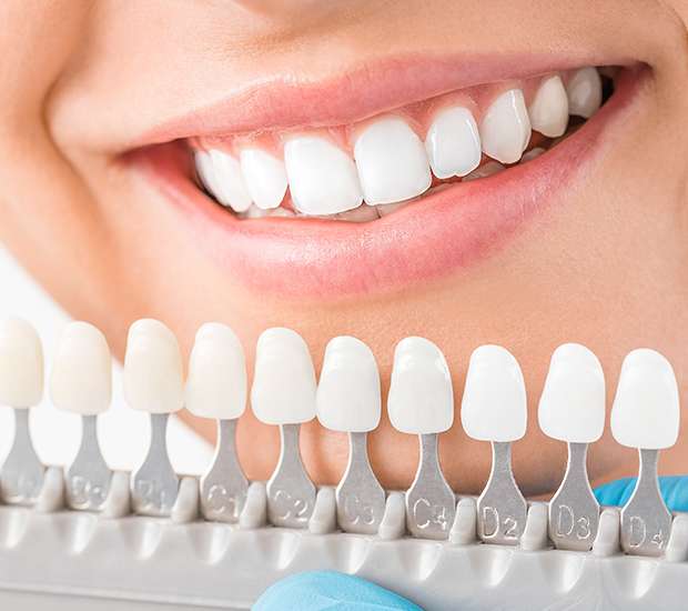Chapel Hill Cosmetic Dentist