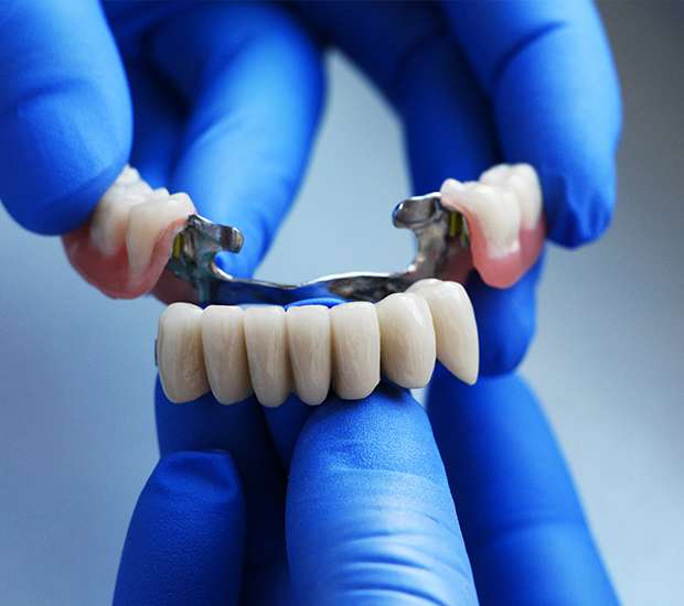 Chapel Hill Dental Bridges