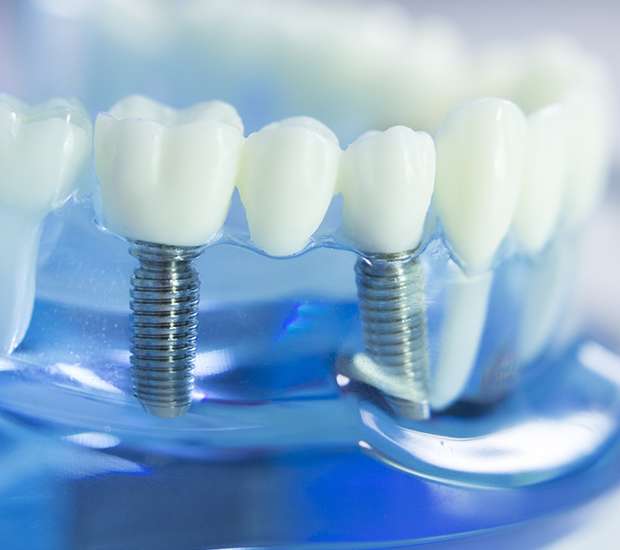 Chapel Hill Dental Prosthetics