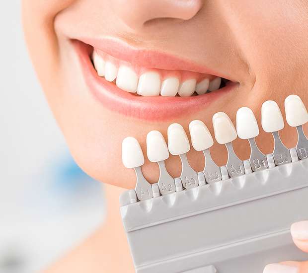Chapel Hill Veneers