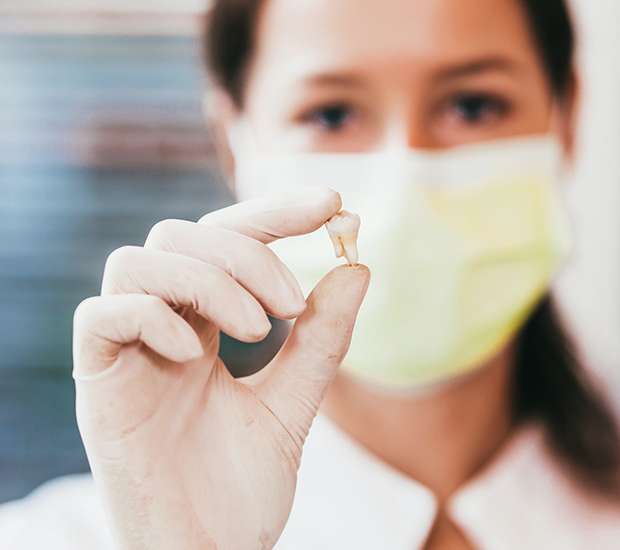 Chapel Hill Tooth Extraction