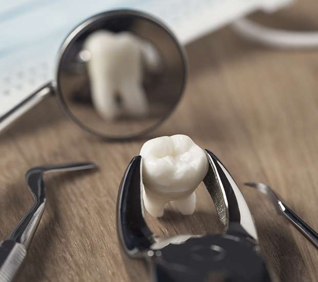 Chapel Hill When Is a Tooth Extraction Necessary